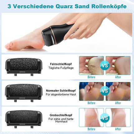 Electric Callus Remover - Electric Callus Remover for Feet - Electric Callus Planer for Feet with 2 Gears, IPX7 Waterproof Callus Remover for Cracked Heels, Dead Skin, Callus Removal