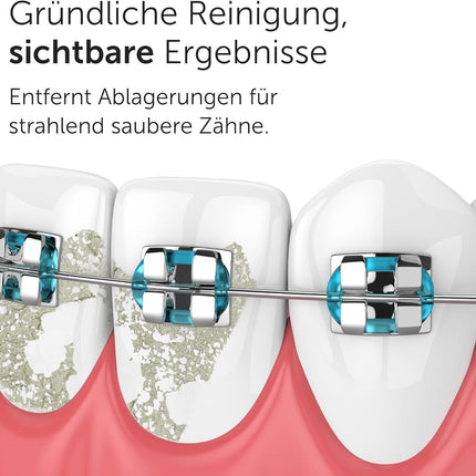 Wondersmile Oral Irrigator PRO - Test Winner 2024 - TÜV-tested - 100-day risk-free trial - SmoothFlow technology for optimal tooth and gum care - 5 modes - 30-day power battery life