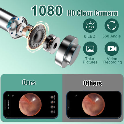 Earwax Remover Otoscope, LMECHN 1080P HD Otoscope, WiFi Ear Cleaner with Camera, Otoscope with 6 LEDs, IP67 Waterproof Otoscope Ear, for iPhone, Android, iPad, Black