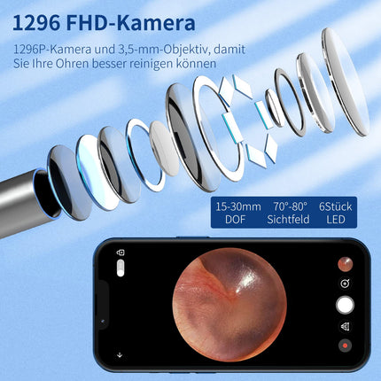 Earwax Remover Otoscope, VITCOCO WiFi Ear Cleaner Camera 5MP HD Ear Camera IP67 Waterproof Otoscope 3.5mm Lens Ear Endoscope with 6 LEDs for iPhone, iPad and Android Smartphones (Black)