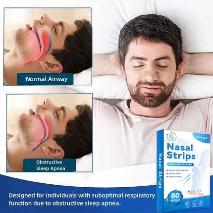 Nose Patches Snoring, 80 Pieces Nose Patches Better Breathing, Nasal Strips, Cold, Allergies, Anti Snoring Patches for Sports and Sleep, Anti Snoring Patches for Sleep Against