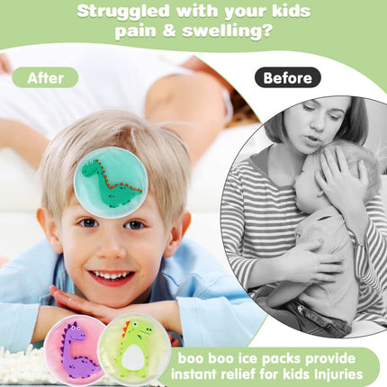 Hilph Cooling Pads for Children with Non-Toxic Gel for Injuries (3 Pack), 11 x 11 cm Dinosaur Small Ice Packs Cold &amp; Warm Compress Ice Pack for Wisdom Tooth, Bumps, Fever, Bruises, Insect Bites