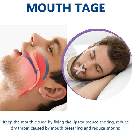 Mouth Tape for Sleeping, 120 Pieces Mouth Tape for Sleeping, Anti Snoring Sleep Patches and Mouth Tape, Helps Against Snoring and Developing the Habit of Nasal Breathing