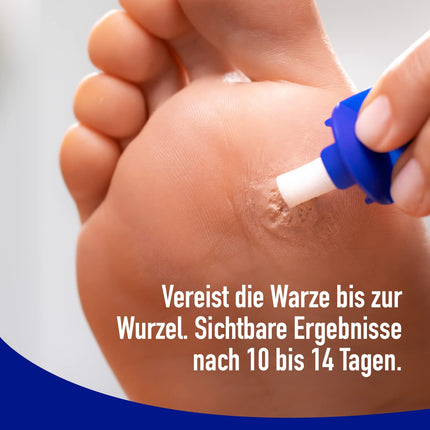 WARTNER Wart Freezing Spray for Plantar Warts - Spray for the Treatment of Plantar Warts - Wart Cryotherapy for Self-Treatment for Children and Adults - 1 Pack, 1 x 50ml