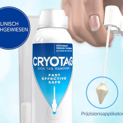 Cryotag Skin Tag Remover - Fast Acting Safe - Clinically proven freezing agent for the treatment of skin tag warts, up to 12 applications