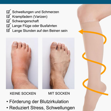 Medical compression stockings for women and men, 20-30 mmHg Class 2, sizes S-4XL, graduated support compression socks, support stockings for varicose veins, edema, and flight (beige, XXL)