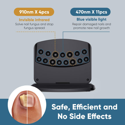 Berrlly nail fungus laser device, upgraded nail fungus laser device, enhanced 910nm infrared + 470nm blue light, height adjustable, can treat multiple nails at once, safe and reliable