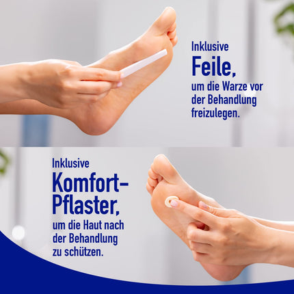 WARTNER Wart Freezing Spray for Plantar Warts - Spray for the Treatment of Plantar Warts - Wart Cryotherapy for Self-Treatment for Children and Adults - 1 Pack, 1 x 50ml