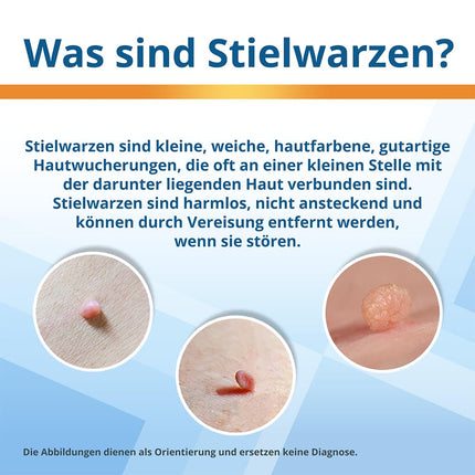 EndWarts EXTRA: Treating pedunculated warts, freezing solution for treating pedunculated warts on the neck, chest &amp; armpits, 9 disposable tips &amp; 9 plasters, patches, spray