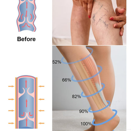 2 Pairs of Medical Compression Stockings for Women &amp; Men 20-30 mmHg, Class 2, Open Toe Graduated Support Stockings for Varicose Veins, Edema, and Flight (2x Beige, XXL)