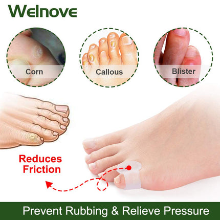 Welnove Toe Separators, Gel Toe Spreaders, Small Bunion Corrector to Prevent Friction and Relieve Pressure (12 Pieces)