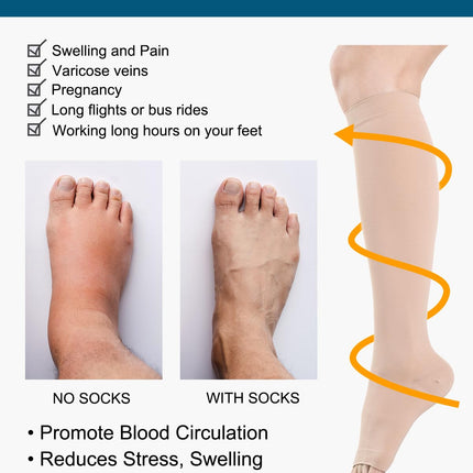 Open Toe Medical Compression Stockings Women &amp; Men 20-30 mmHg Class 2, Size S-4XL, Compression Socks Support Stockings for Varicose Veins Edema Flight (Beige, M)