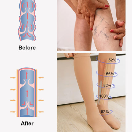 2 Pairs of Medical Compression Stockings for Women &amp; Men 20-30 mmHg, Class 2, Closed Toe Graduated Support Stockings for Varicose Veins, Edema, and Flight (2x Beige, L)