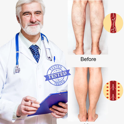 2 Pairs of Calf Medical Compression Stockings for Men &amp; Women 20-30 mmHg, Class 2, Calf Support, Graduated Support Stockings for Varicose Veins, Edema, Flight Sports (Black+Beige, L)