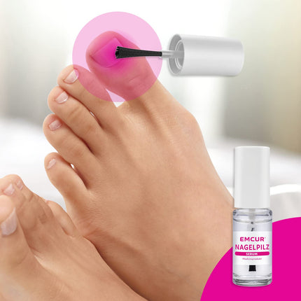 Emcur® Serum | with treatment plan | with 10 nail files | toenails and fingernails | as a bottle with applicator | 5 ml | sufficient for up to 3 months