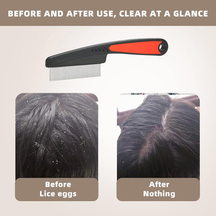 Dandruff comb with metal teeth, stainless steel fine tooth comb head comb comb dandruff comb adult dandruff comb comb against dandruff comb dandruff comb hair anti-dandruff comb