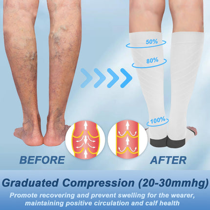 beister 20-30 mmHg Medical Compression Stockings for Women &amp; Men, Open Toe Calf Compression Knee Highs, Graduated Support Stockings for Varicose Veins, Edema, Pregnancy