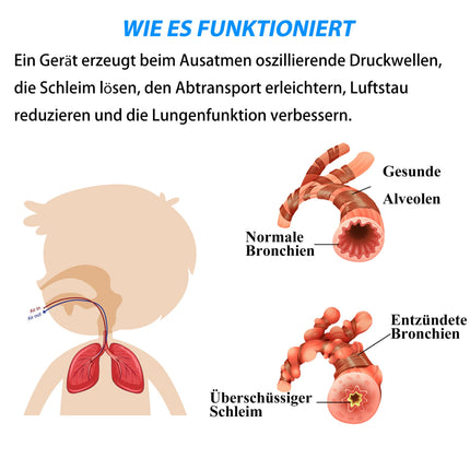 MillSTEPS Breathing Trainer Mucus Removal Device OPEP Device Exercise to Improve Lung Capacity &amp; Naturally Remove Mucus from the Airways