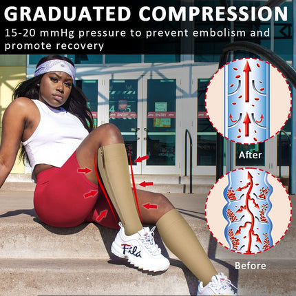 Ailaka Compression Stockings with Zipper, 15-20 mmHg Class 1 Compression Stockings for Women and Men, Open Toe Support Stockings for Varicose Veins, Edema, Recovery, Pregnancy