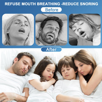 Pack of 8 anti-nose clips, anti-snoring nose clip, snoring clips, snoring stopper, anti-snoring sleep clips, snoring stopper, reusable anti-snoring, sleep clips for relaxed nights