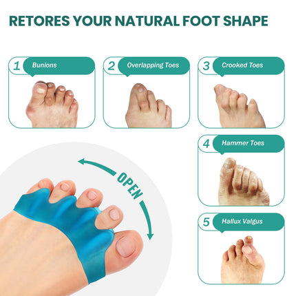 Welnove Silicone Toe Separators for Correcting Hallux Valgus - 8 Pack Toe Spreaders for Men's Feet - Hammer Toe Straightener for Women, Yoga Exercises, Foot Alignment - Blue