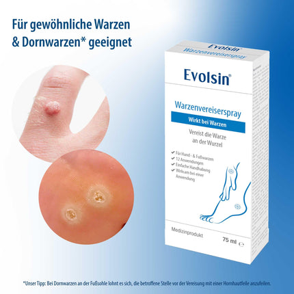 Evolsin® Wart Freezer for common warts &amp; verrucas | Wart freezing hygienic &amp; safe | Wart remedy