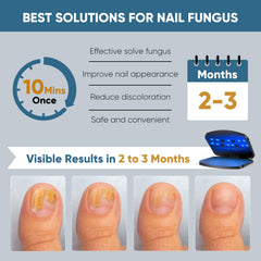 Berrlly nail fungus laser device, upgraded nail fungus laser device, enhanced 910nm infrared + 470nm blue light, height adjustable, can treat multiple nails at once, safe and reliable