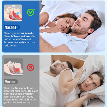 Nose Patches for Snoring, 80 Pieces Extra Strong Nose Patches for Better Breathing, Breathable Nose Strips Relieve a Blocked Nose, Effective Anti-Snoring, Nose Strips for Sports and Sleep