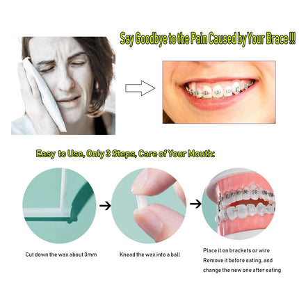 Orthodontic Wax for Braces, Dental Wax for Braces Wearers to Relieve Irritation and Pain, Dental Care Sets, 10 Pieces, 10 Colors