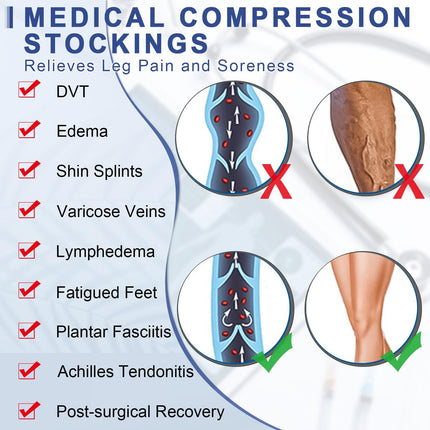 Beister Medical Compression Stockings for Women &amp; Men, Thigh Support Stockings with Open Toe 20-30 mmHg Graduated Support, Edema Compression Socks for Deep Vein Thrombosis, Flight