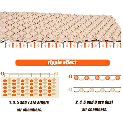 YUNZHIDUAN Alternating Pressure Mattress, Air Topper Pad for Bedsores, Medical Air Mattress with Pump, for the Prevention of Lecer, Treatment of Bedridden Patients - Inflatable, Suitable for Hospital Bed