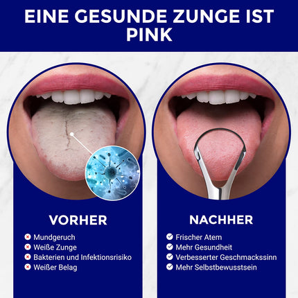 Stainless steel tongue scraper | Tongue cleaner set | Tongue cleaner | Stainless steel tongue brush | Stainless steel tongue scraper | Tongue scraper | Stainless steel tongue cleaner | ORAVIX