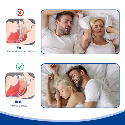 Nose plasters, snoring stopper, nose plasters, snoring, nose strips, anti-snoring, nose strips, better breathing, nasal dilator, nasal strips, effective aids against snoring, better sleep (50 pieces)