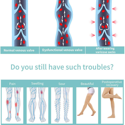 Evolyline Medical Compression Stockings Women Men, Thigh High Support Stockings with Silicone Band, 20-30 mmHg Compression Socks for Air Travel Sports Graduated Support for Varicose Veins