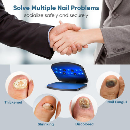 Berrlly nail fungus laser device, upgraded nail fungus laser device, enhanced 910nm infrared + 470nm blue light, height adjustable, can treat multiple nails at once, safe and reliable