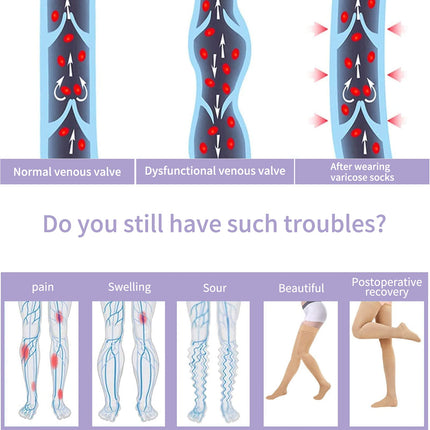 Evolyline Medical Compression Stockings, 20-30 mmHG Support Stockings for Women &amp; Men, Medical Class 2 Thigh Highs, Prevent Varicose Veins