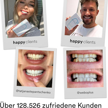 Uniquesmile Teeth Whitening Strips - Test winner 2024 - 100 days risk-free trial - peroxide-free - innovative formula with natural ingredients (value pack of 40 strips)