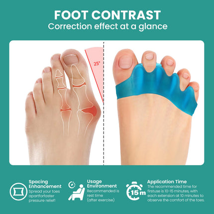 Welnove Silicone Toe Separators for Correcting Hallux Valgus - 8 Pack Toe Spreaders for Men's Feet - Hammer Toe Straightener for Women, Yoga Exercises, Foot Alignment - Blue