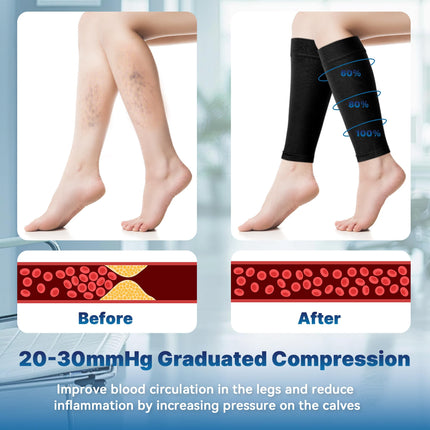 BellaAchtung Calves Medical Compression Stockings Women &amp; Men Compression Socks Medical with 20-30 mmHg Graduated Support Thrombosis Stockings Support Stockings for Varicose Veins Edema