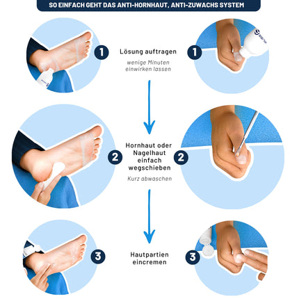 Mr. Fuss Callus Remover Solution for Gentle Callus Removal. Fast-Softening Lotion 250ml No. 4 in the Plus Pack. Foot Care Pedicure Set without Sanding with Instant Effect.