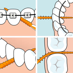 TePe EasyPick Dental Picks, Orange, ISO XS-S, 60 pcs., efficient interdental cleaning, durable dental pick for small gaps