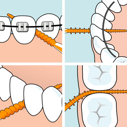 TePe EasyPick Dental Picks, Orange, ISO XS-S, 60 pcs., efficient interdental cleaning, durable dental pick for small gaps