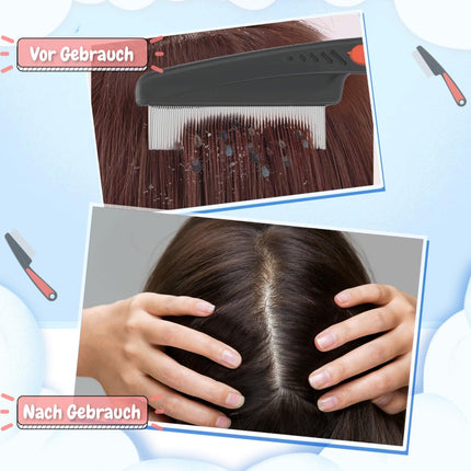Lice Comb, 3-Piece Flea Comb, Nit Comb, Fine-Tooth Flea Comb for Dogs, Stainless Steel Tick Comb for Cats, Lice Comb for Long Hair, Children, Adults, and Pets, Dandruff Removal (Black)