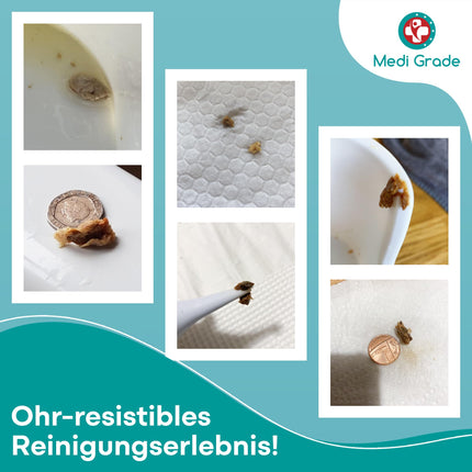 Medi Grade Ear Cleaning - Earwax Remover - Safe Pump for Earwax Removal 300 ml - Environmentally Friendly Ear Cleaning Set - Improves Hearing