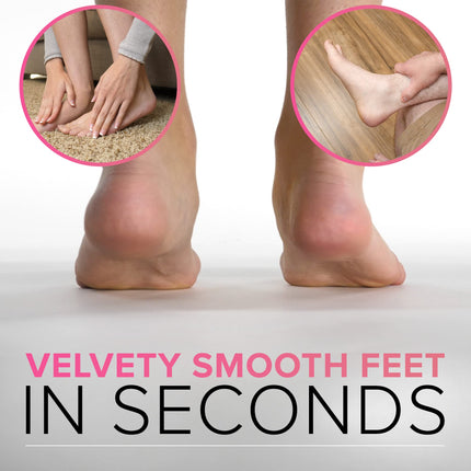 ULTIMATE Callus File Callus Remover For Foot Care (Large) MEGAFILE Callus Planer For Callus Removal Foot - Callus Rasp For Callus Remover Heavy Calluses Dead Skin Foot Scraper