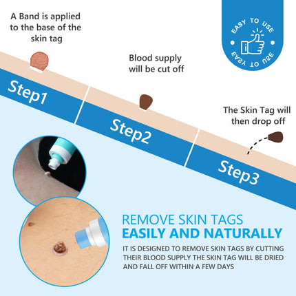 Skin Tag Removal, 2 Sizes Auto Remover Pen Set, Effective, Painless, Easy, and Safe for Small to Large Skin Warts and Moles (1-9 mm). Safe for Most Body and Face Areas