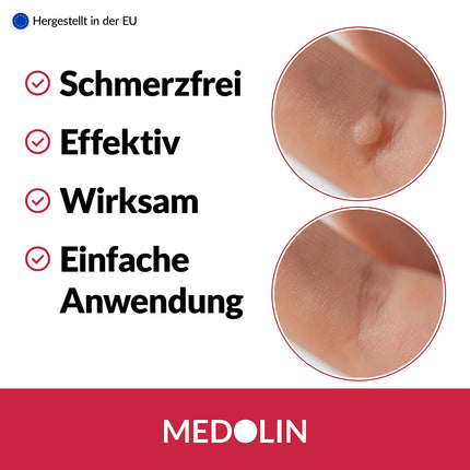 Medolin® Wart Tincture - Effective wart remedy - Scientifically proven effectiveness - Easy &amp; painless application - Removes warts, 2 ml