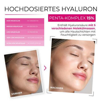 250 ml Hyaluronic Acid Serum Concentrate TEST WINNER • 5x Hyaluronic Acid • Clinic Size • Anti Aging Gel with Vitamin C Pro • Clear Skin Complex • Hypoallergenic • Made in Germany