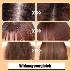 3-piece dandruff comb, lice comb, lice comb for humans, multifunctional hairdressing tools. Satisfy daily use, for family school trips or gym use.