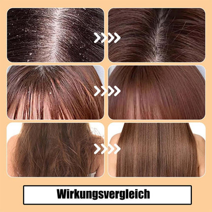 3-piece dandruff comb, lice comb, lice comb for humans, multifunctional hairdressing tools. Satisfy daily use, for family school trips or gym use.